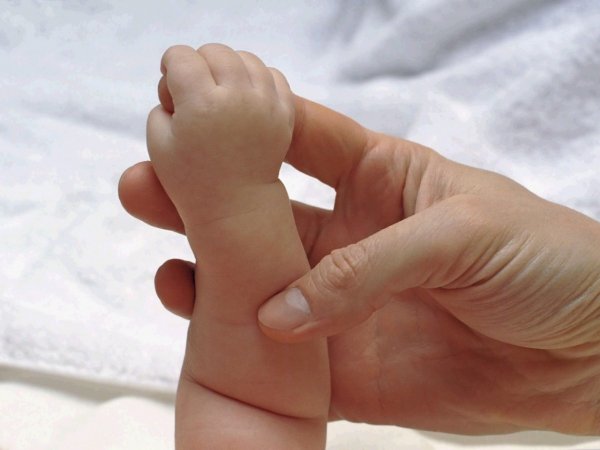 В Уфе медики ампутировали новорожденной девочке руку