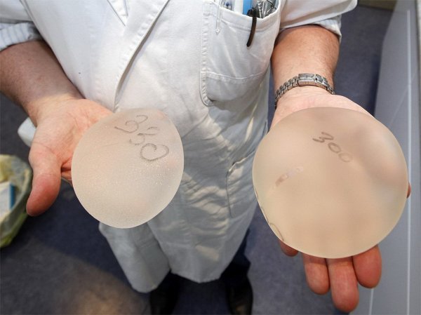 В восточной части Москвы похитили импланты для пластики груди