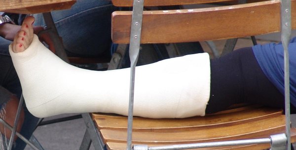 В Курской области женщина со сломанной ногой выползала из больницы