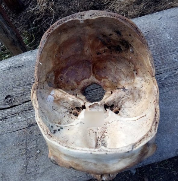 Житель Новосибирской области нашёл во дворе распиленный человеческий череп